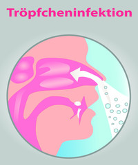 Tröpfcheninfektion_T2