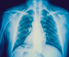 Medical X-rays