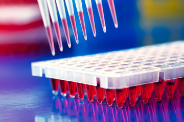 DNA samples are loaded to 96-well plate for PCR analysis