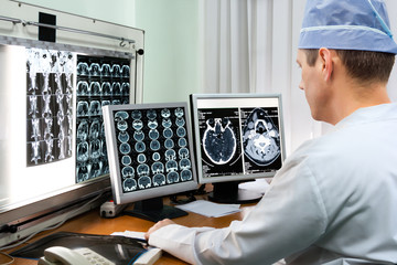 Doctor examining x-ray images