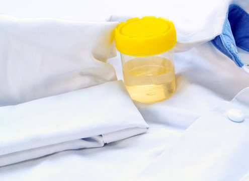 Analyse d'urine