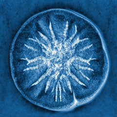 macro X-ray shot of fuzzy mold