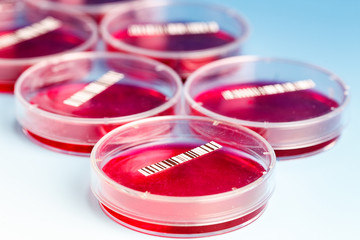 petri dish with blood samples