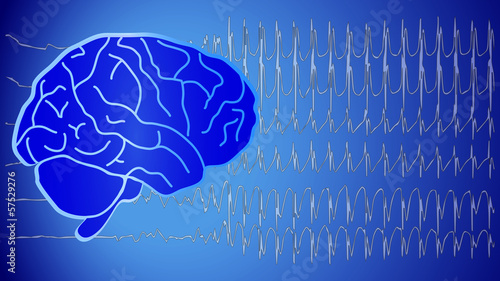 “Brain Wallpaper EEG Neurology” Stock image and royalty-free vector