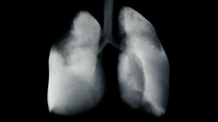 Smoking lungs concept