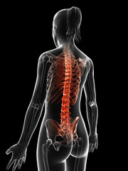 painful spine