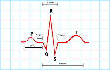 Normal Atrial And Ventricular Depolarization Description