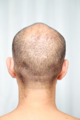 Fototapeta premium 薄毛