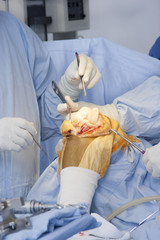 Operation