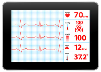 Modern Electrocardiogram Monitor Device Display