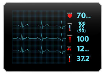 Modern Electrocardiogram Monitor Device Display - 57825052