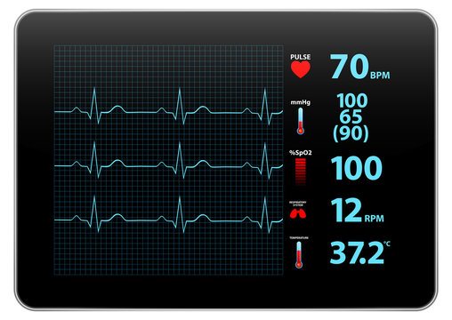 Modern Electrocardiogram Monitor Device Display
