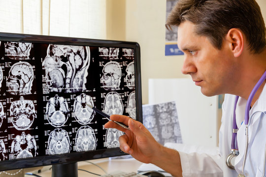 Doctor examining an MRI scan of the Brain
