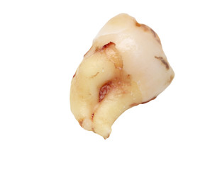 tooth on a white background. macro