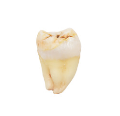 tooth on a white background. macro