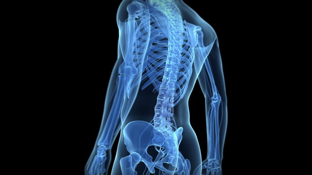 Animation showing pain in the lower back