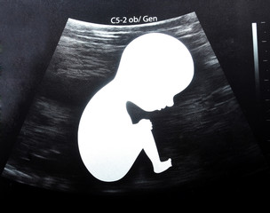 Close up Ultrasound Picture baby