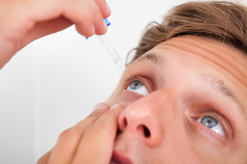 Young Man Putting Eye Drops In His Eyes