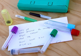 tubes pour prise de sang