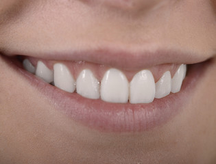 Weisse Zähne