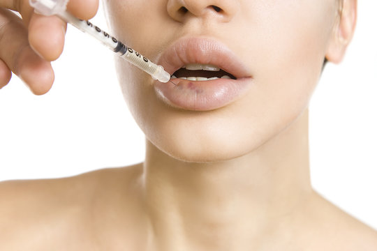 woman getting an injection - real lip bruise after injection