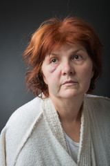 Abused woman