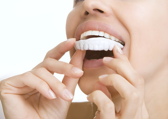 teeth Whitening - smiling girl with tooth tray