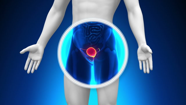 Medical X-Ray Scan - Bladder