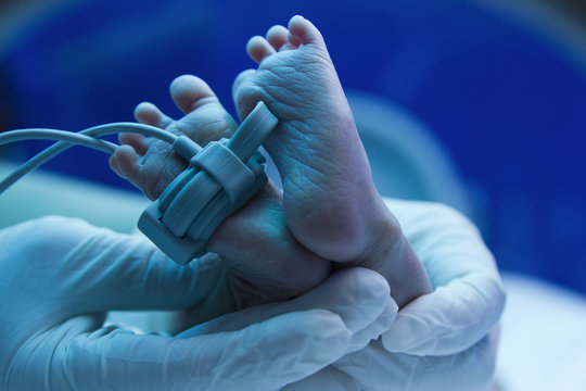 Doctor's hand care for a sick new born baby in the pediatric ICU