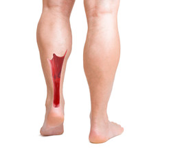 achilles tendon with lower leg muscles - 58900214