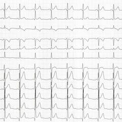 cardiogram