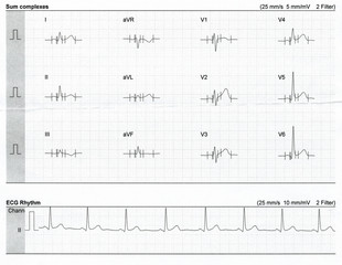 cardiogram