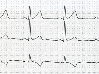 cardiogram