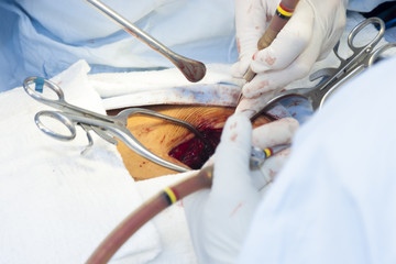 Surgical procedure
