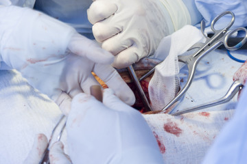 Surgical procedure