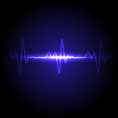 Electrocardiogram