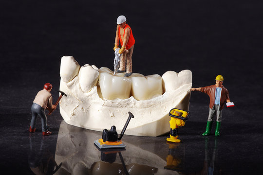 3 Miniatur Arbeiter auf Zahn Ersatz Nahaufnahme