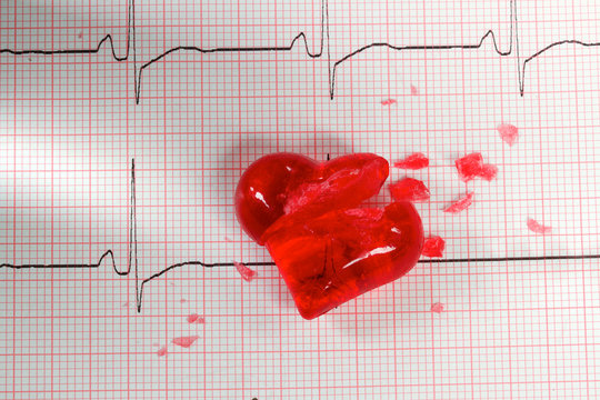 Broken Heart Of Glass On A ECG Cardiogram