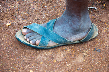 foot of a black african man