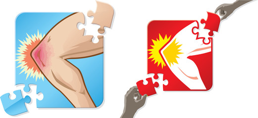 Solution to knee pain