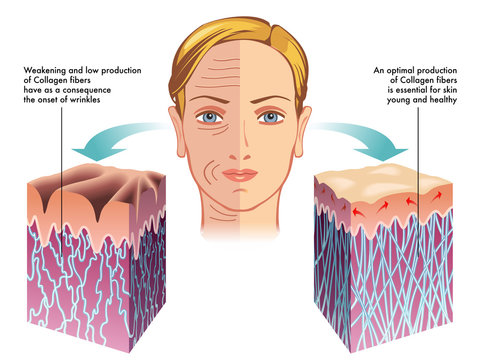 collagene