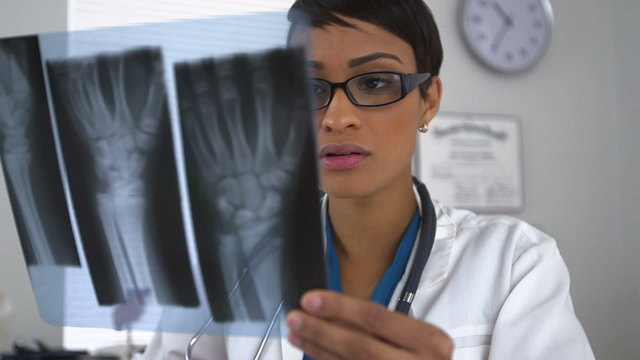 Doctor looking at x-rays of broken wrist