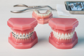 dentures and braces