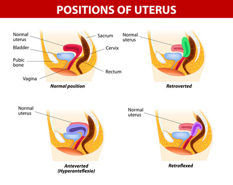 Positions of uterus