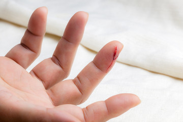 Injured finger with bleeding open cut