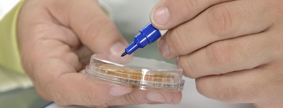 Probenanalyse Abklatschtest