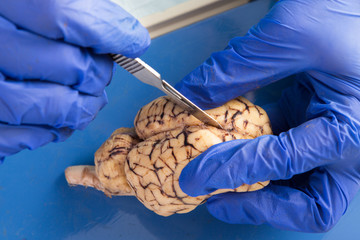 Student using a scalpel to dissect a cow brain