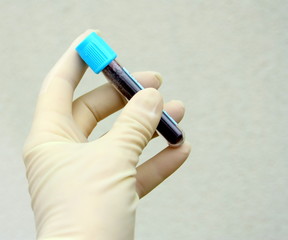 tube de prélèvement sanguin humain,