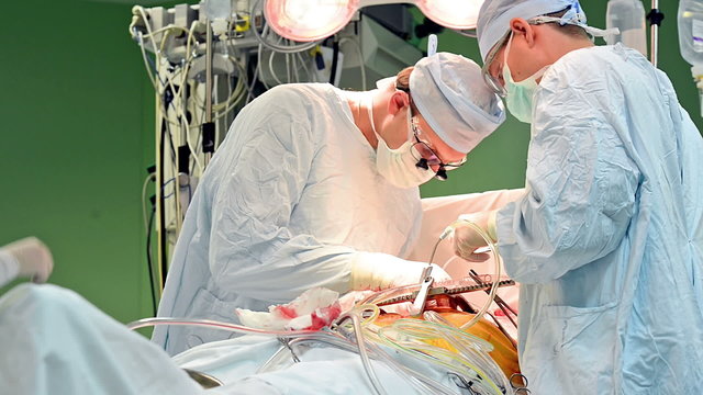 surgeons team at operation