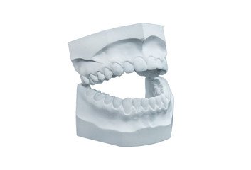 Dental plaster cast on white background